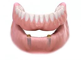 Removable Teeth Replacement